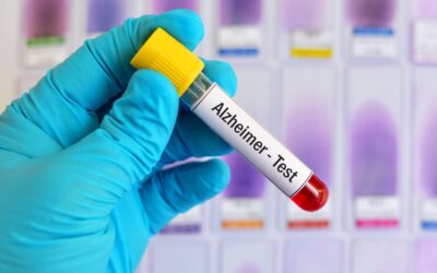 Estudios del Alzheimer: cómo avanza la enfermedad