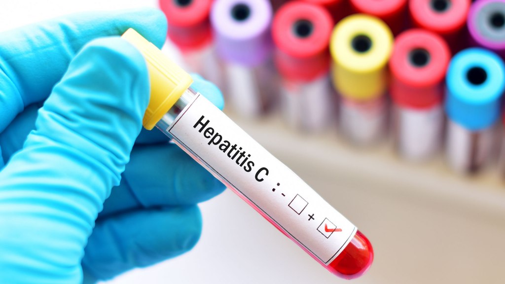 Argentina registra entre 700 y 800 casos de Hepatitis C cada año
